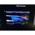 Kardiale tragbare Farbdoppler-Ultraschall-Maschinen-Preis-medizinische Sonar 2D 3D Echokardiographie Ecografo USD Echo-Maschine 4D